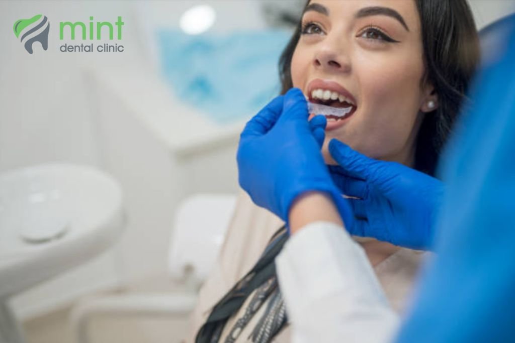 image of bite impressions