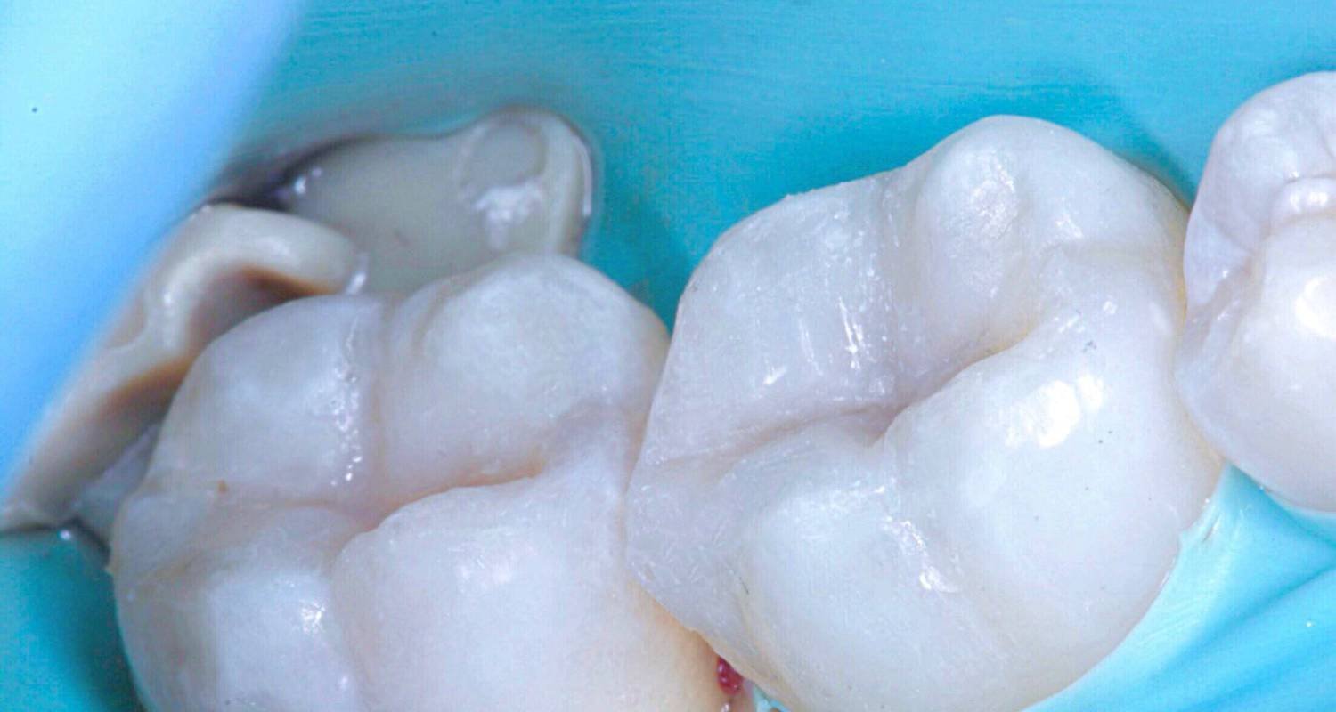 after white filling image