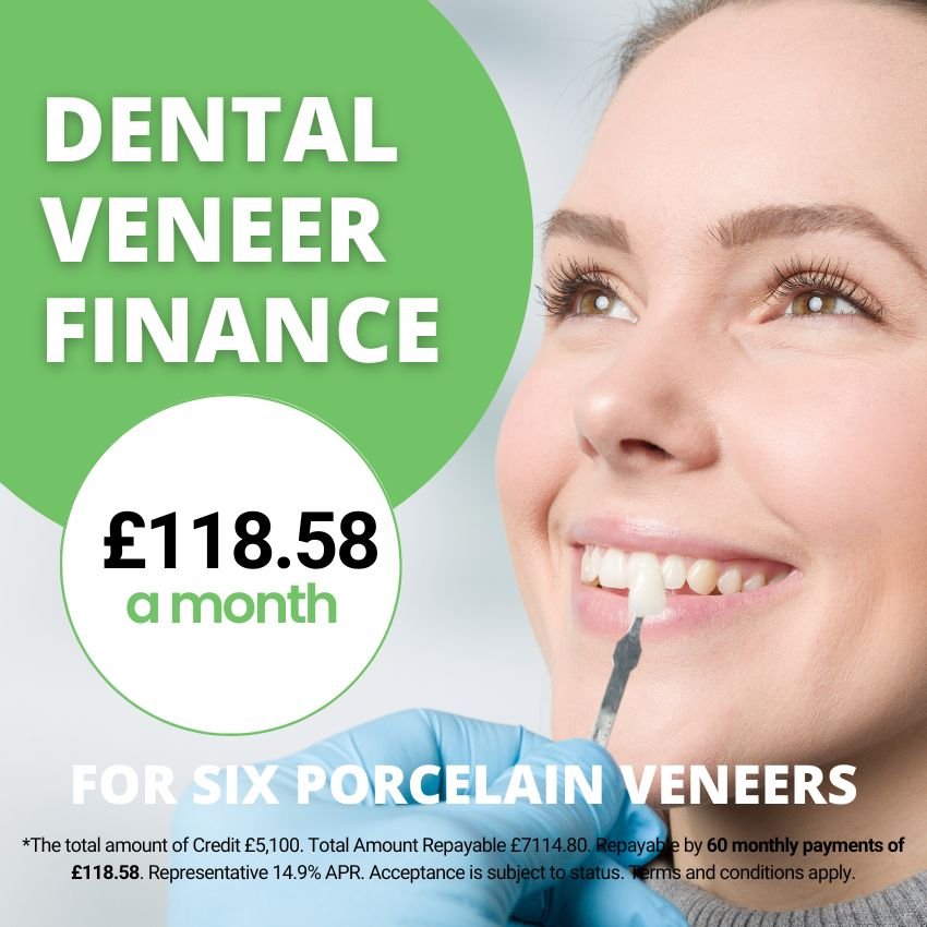 veneer costs