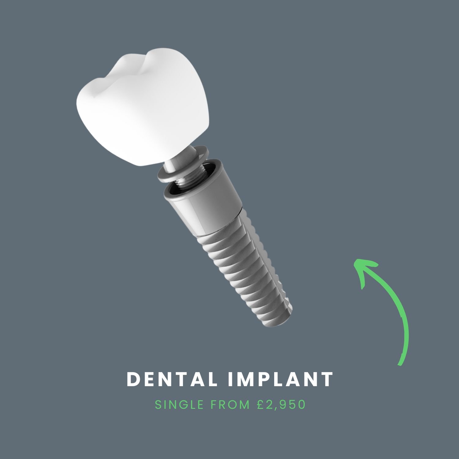 dental implant illustration
