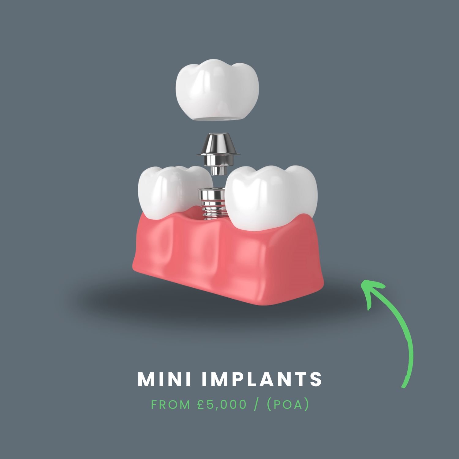 mini implants photo
