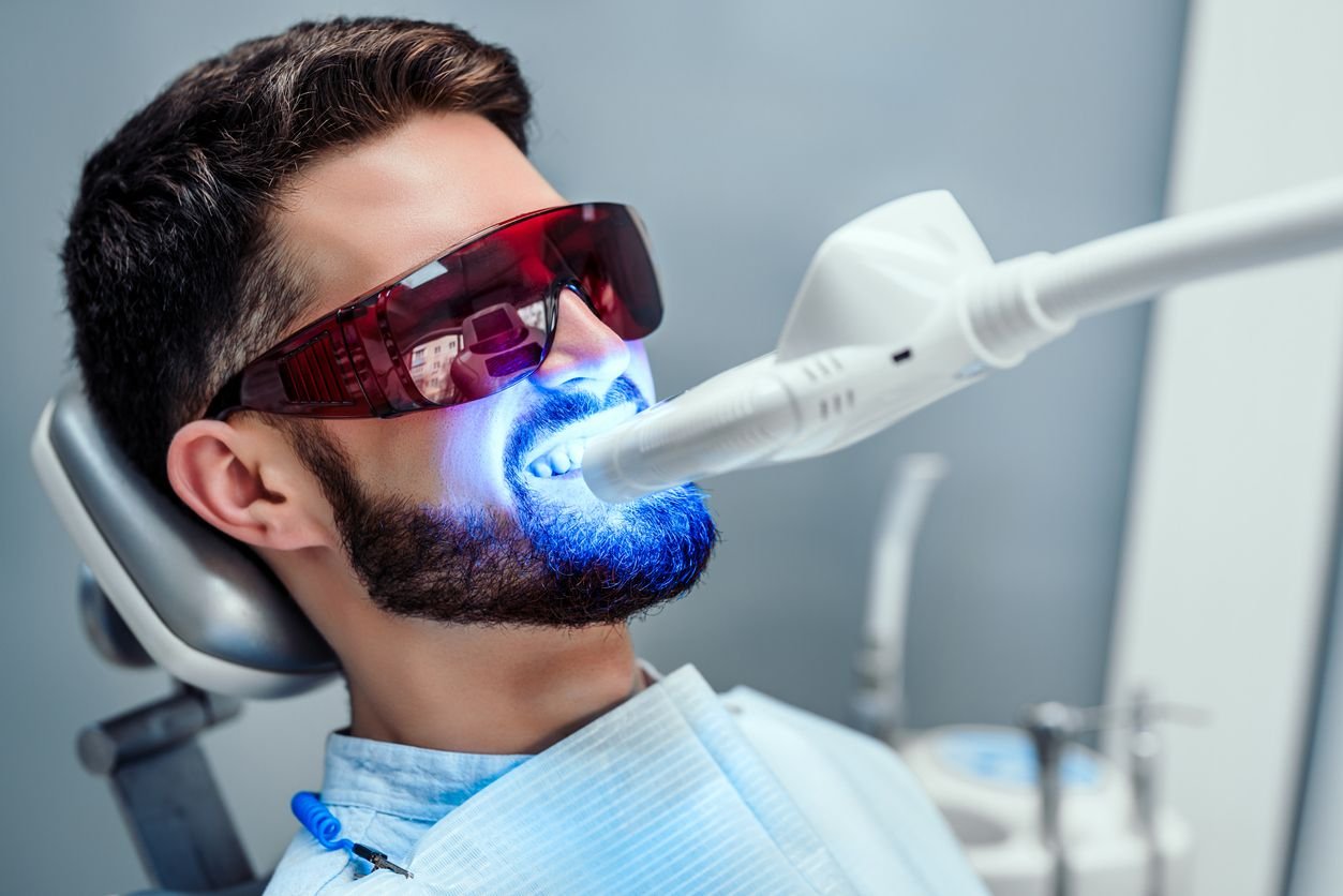 laser teeth whitening image