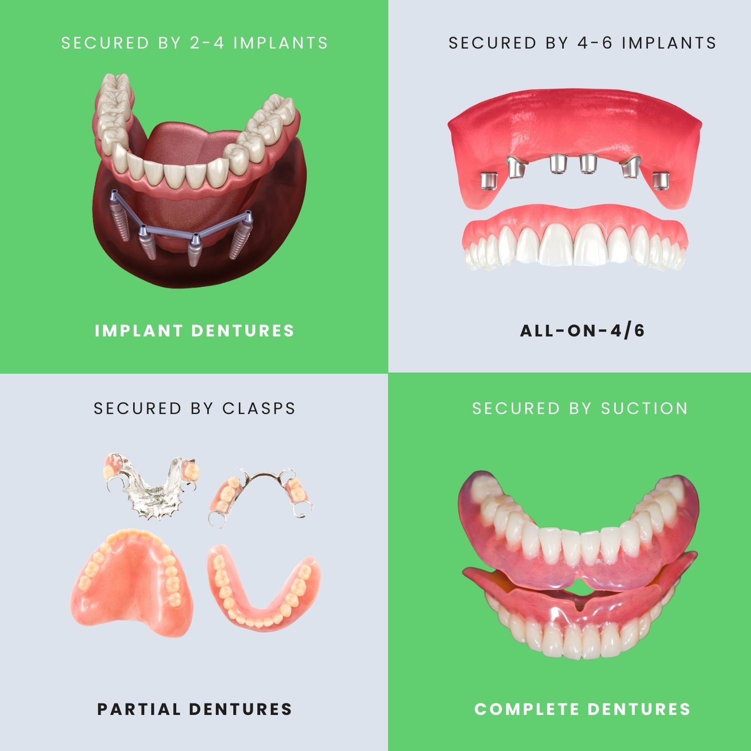 missing teeth comparison